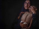 Replay Israël-Palestine : le conflit sans fin - Gaza: quand la famine menace