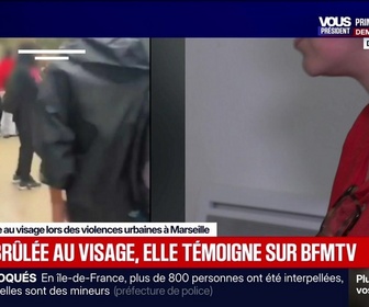 Replay Fauvelle Week-end - Brûlée au visage, elle témoigne sur BFMTV - 03/10