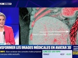 Replay Tech & Co, la quotidienne - Avatar Medical lève 5 millions d'euros pour démocratiser l'accès aux images médicales 3D - 15/02