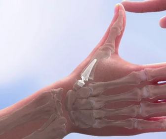 Replay Le Mag de la santé - 30/03/2026