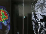 Replay Le doc du Mag santé - Émission du vendredi 15 août 2025