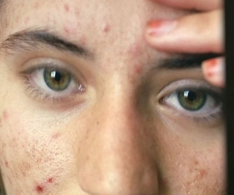 Replay ARTE Journal - Close Enough, des femmes photographes exposées à Berlin