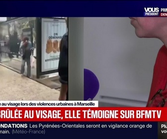 Replay BFM Grand Soir - Brûlée au visage, elle témoigne sur BFMTV - 03/10